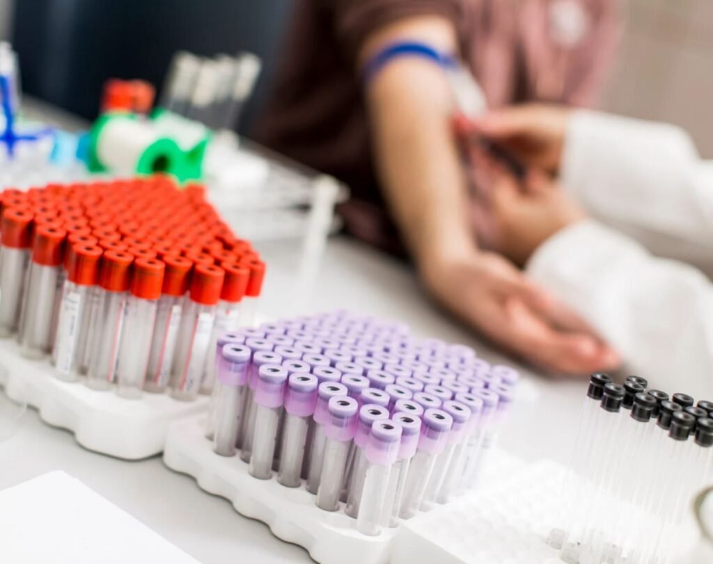 Blood test tubes prepared in a medical lab, which are part of the visa medical tests required at Al Karama Medical Center in Dubai