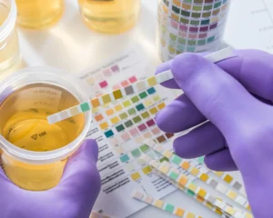 Gloved hands holding a urine test strip above a sample for drug testing in Singapore
